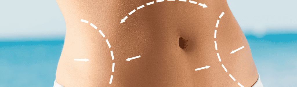 Ankara liposuction ameliyatı - Op. Dr. Selçuk Yüce